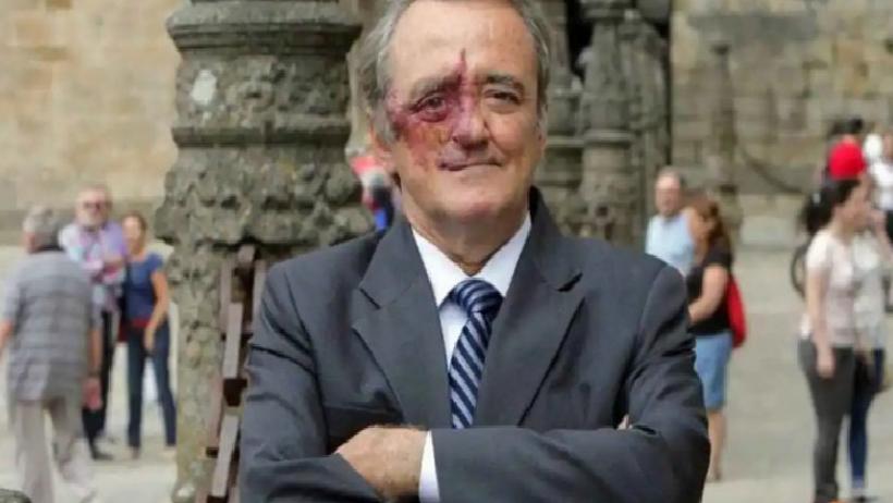 Pankreas Kanserinde Umut Veren Gelişme: Üçlü Tedaviyle Hayvan Deneylerinde Tam İyileşme