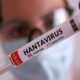 hantavirusun yayilma nedeni iklim degisikligi mi WNAUQY1E 80x80