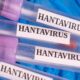 saglik bakanligindan hantavirus aciklamasi guncel bilgilendirme pKVRWATI 80x80